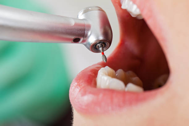 Best Emergency Treatment for Jaw Pain or Injury in Riverdale Park, CA